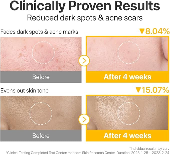 Numbuzin – No.5+ Glutathione Vitamin Concentrated Pad – 180ml70pads